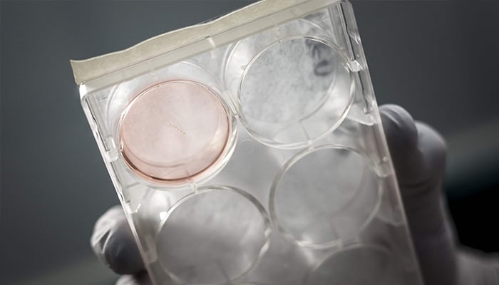 A box containing six human brain cells is photographed at the Swiss start-up FinalSpark in Vevey, on October 3, 2025. — AFP